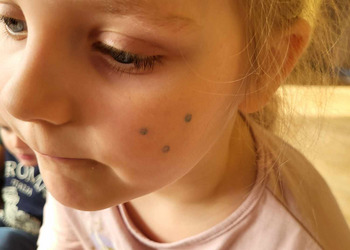 Dzień Piegów z przedszkolakami