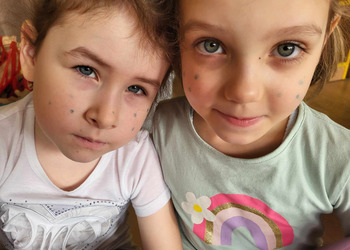 Dzień Piegów z przedszkolakami